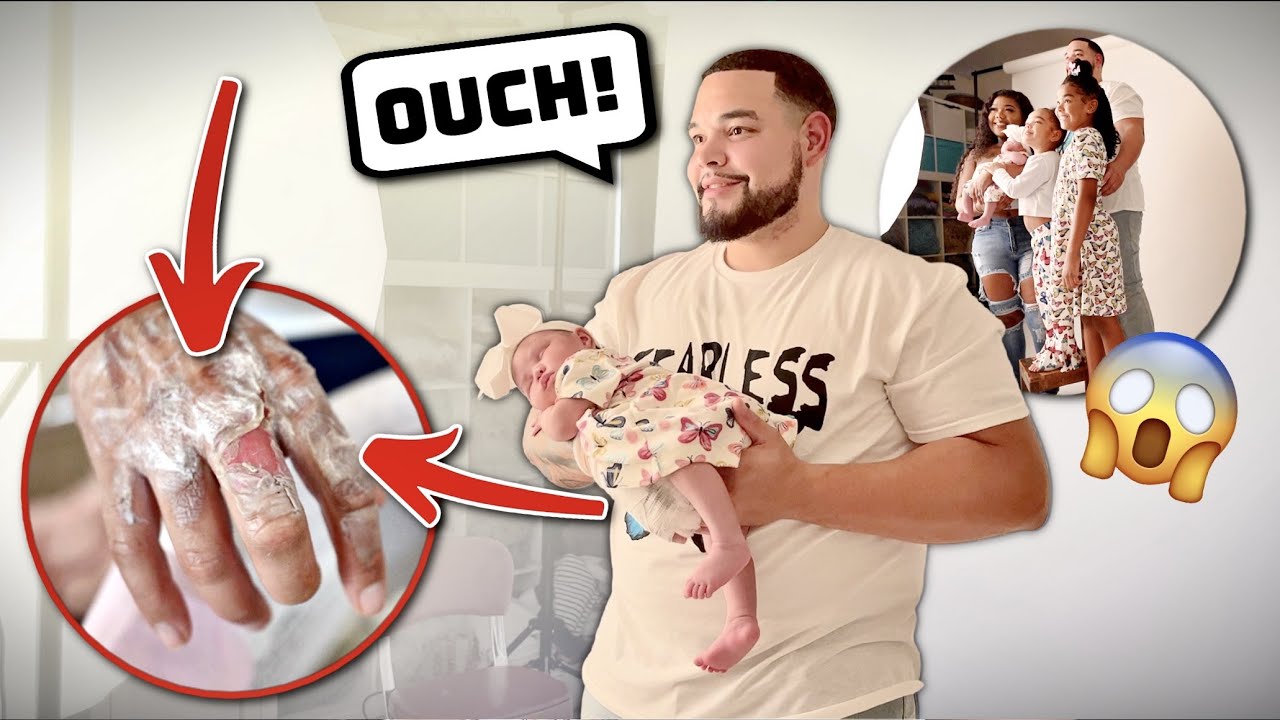 Uriah Got Burned REAL BAD • Baby's Newborn Photoshoot • Doctor's Visit
