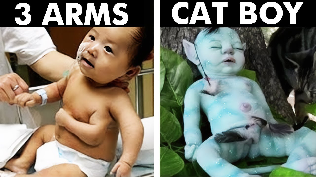 TOP 15: Children with Incredibly Unique Characteristics